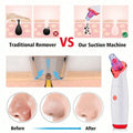 2026 Blackhead Remover Pimple Acne Removal Blackhead Vacuum Tool Skin Care Pore Cleaner Rechargeable