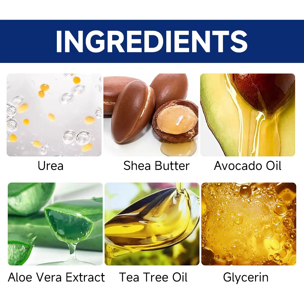 60% Urea Foot Cream for Cracked Heels & Dry Skin - Intensive Moisturizing Treatment, Callus Remover, Diabetic Foot Care.