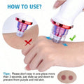 2026 Blackhead Remover Pimple Acne Removal Blackhead Vacuum Tool Skin Care Pore Cleaner Rechargeable