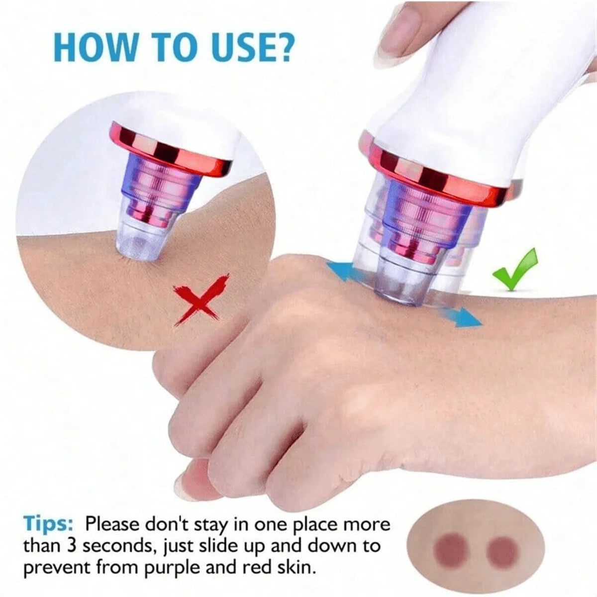 2026 Blackhead Remover Pimple Acne Removal Blackhead Vacuum Tool Skin Care Pore Cleaner Rechargeable