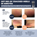 Electric Hard Skin Remover for Men by : Usa'S Best Rated Callus Remover- Rechargeable Pedicure Tools W 3 Coarse Rollers, Velvet-Smooth Foot Care Professional Spa Pedi Feet File (USB Cord)