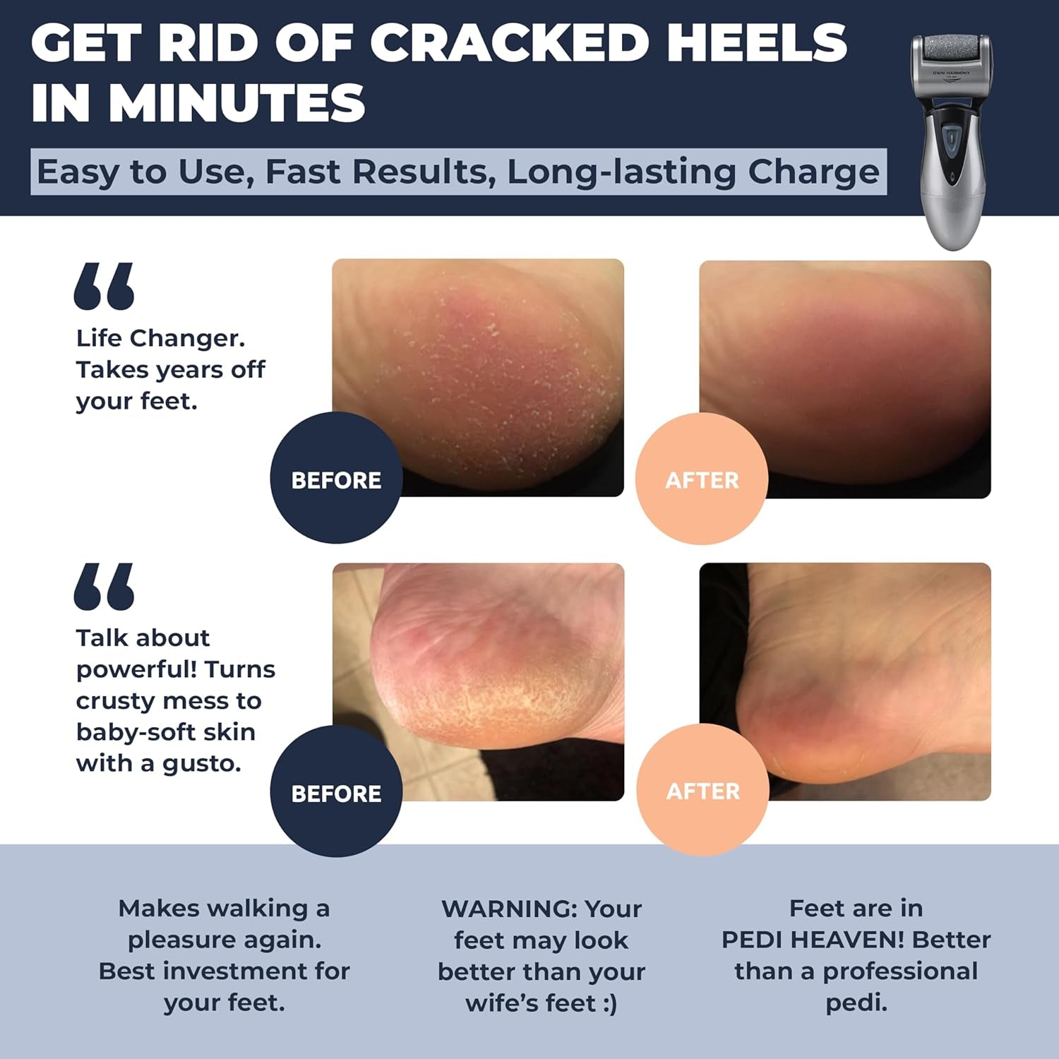 Electric Hard Skin Remover for Men by : Usa'S Best Rated Callus Remover- Rechargeable Pedicure Tools W 3 Coarse Rollers, Velvet-Smooth Foot Care Professional Spa Pedi Feet File (USB Cord)