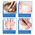 60% Urea Foot Cream for Cracked Heels & Dry Skin - Intensive Moisturizing Treatment, Callus Remover, Diabetic Foot Care.